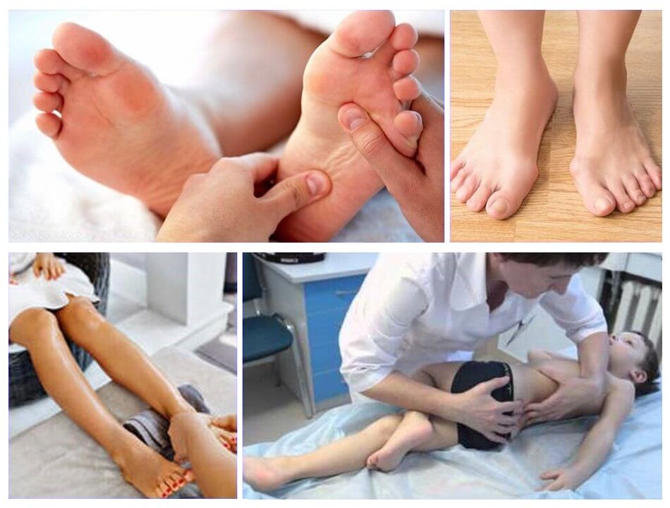 Déformation du valgus chez les enfants Traitement