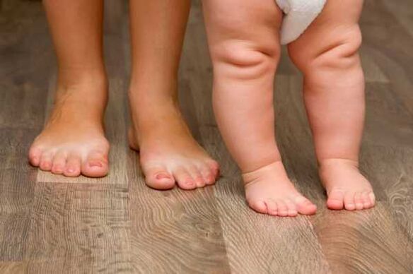 Déformation valgus chez les enfants