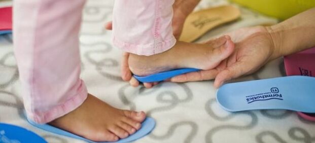 Semelles intérieures avec déformation valgus du pied chez les enfants