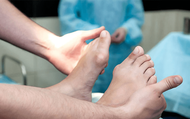 Déformation valgus du pied
